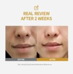 Kojic Acid & Niacinamide Brightening Serum  Dark Spot Remover for Acne Scars, Melasma & Dull Skin - Image 2