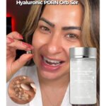 Korean Hyaluronic PDRN Orb Serum Spherical Particles Beads Face Essence Deep Hydration Salmon DNA Plumping Firming Moisturizer - Image 2