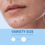 180/360PCS Invisible Acne Veneer Lump Sticker Reduce Acne Cleansing Pores Oil Removal Repair and Smooth Skin Facial Products Var - Image 5