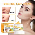 Anti Acne Turmeric Cream, Fades Scars & Dark Spots, for Oily and Dull Skin, Brightening Turmeric Face Care Treatment, 50ml - Image 3