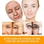 Anti Acne Turmeric Cream, Fades Scars & Dark Spots, for Oily and Dull Skin, Brightening Turmeric Face Care Treatment, 50ml - Image 5