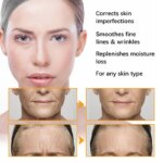 Anti Acne Turmeric Cream, Fades Scars & Dark Spots, for Oily and Dull Skin, Brightening Turmeric Face Care Treatment, 50ml - Image 4