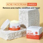 Herbal Acne Treatment Cream Anti Acne Face Cream Pimple Removal Spots Oil Control Shrink Pores Moisturizing Skin Care Cream - Image 2