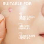 Micro Needle Pimple Patch (24 Pack) Hydrocolloid Micropoint Pimple Patch For Acne & Pimples Microdart Patch, Micro Dart Pimple P - Image 3