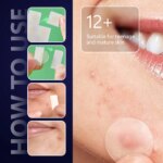 Micro Needle Pimple Patch (24 Pack) Hydrocolloid Micropoint Pimple Patch For Acne & Pimples Microdart Patch, Micro Dart Pimple P - Image 6