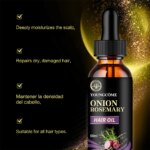Hair Rapid Growth Essential Oil Onion Rosemary Hair Care Essential Oil Hair Regeneration Effective Hair Loss Product - Image 3