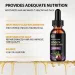 Hair Rapid Growth Essential Oil Onion Rosemary Hair Care Essential Oil Hair Regeneration Effective Hair Loss Product - Image 2